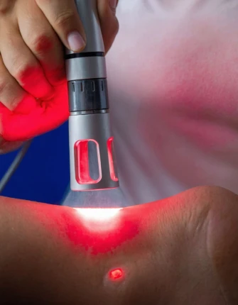What is Laser Therapy?